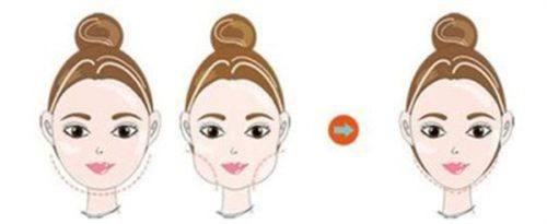 五、提升凹形疤痕治疗成效的实用建议