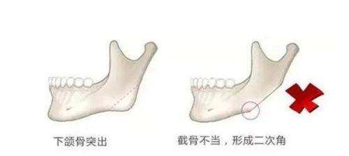 三、皮肤疤痕修复的全新核心技术