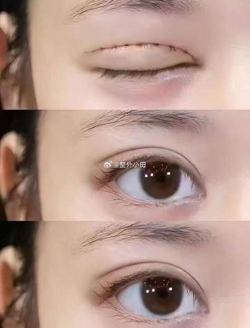 韩国Small Face整形外科医院价格表: