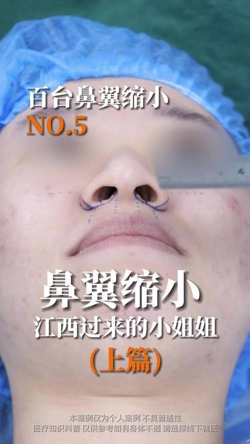 韩国Small Face整形外科医院口碑评价: