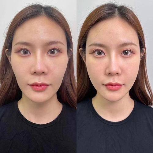 常熟圣莎拉医疗美容门诊部擅长项目: