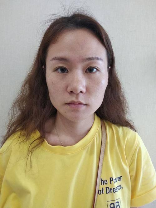 淄博媄妍整形医院价格表：