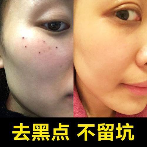 楚雄现代整形美容医院预约挂号方式