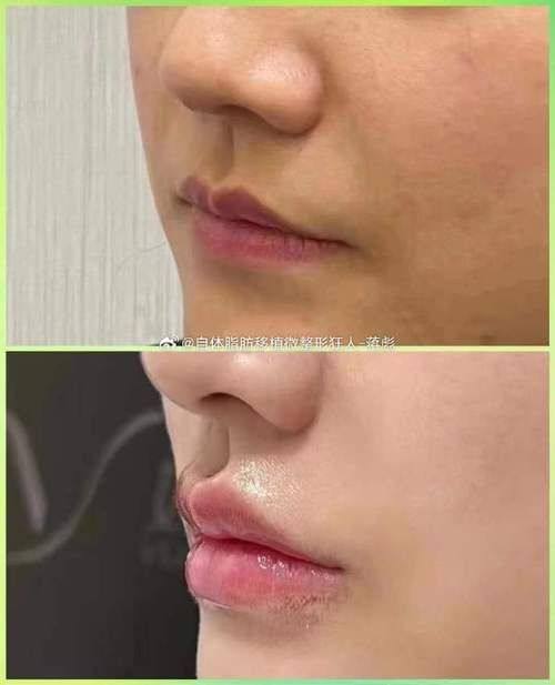 北京爱多邦医疗美容怎么样？