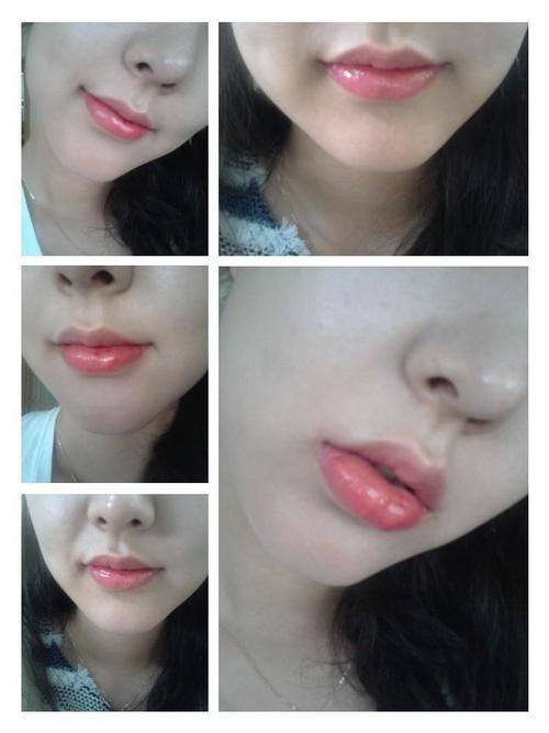 北京爱多邦医疗美容擅长项目：