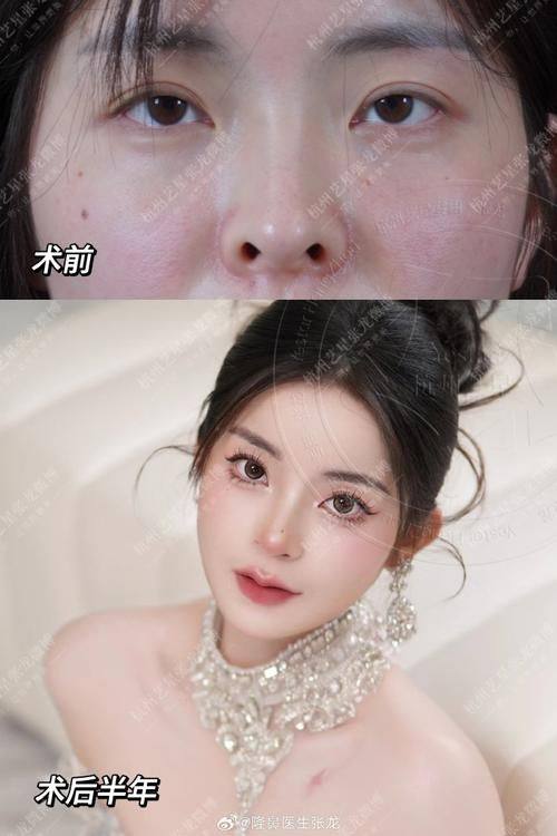 台州博仕整形美容医院地址电话及营业时间: