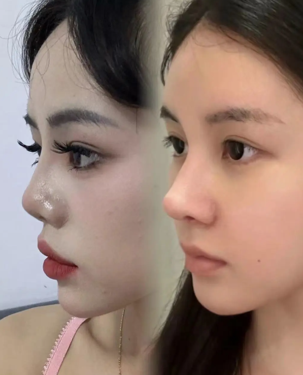 淄博媄妍整形医院口碑评价：