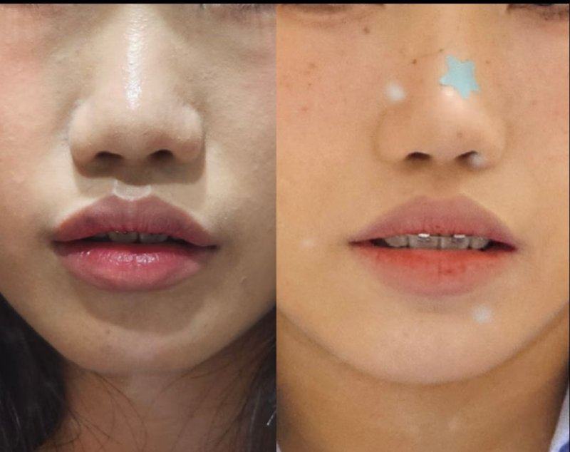 台州博仕整形美容医院口碑评价: