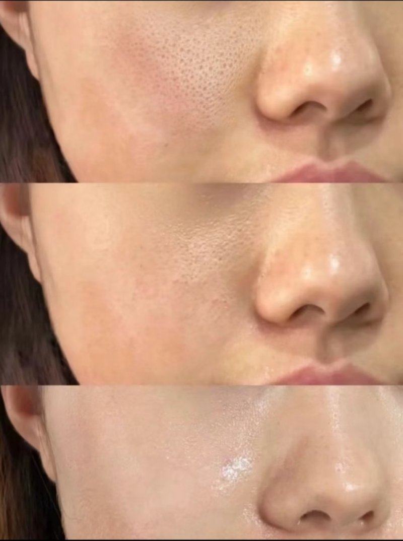 五、正常洗脸后延长成效的日常细节