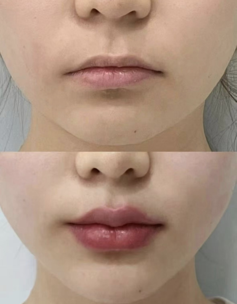 四、术后异常情况与洗脸的应对