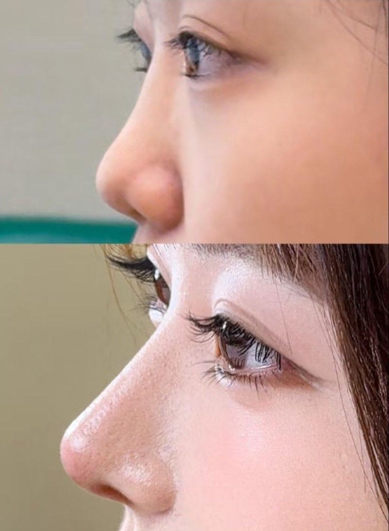 淄博媄妍整形医院预约挂号方式：