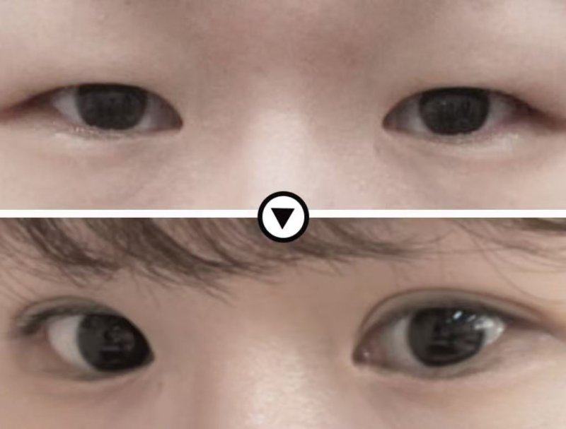 淄博媄妍整形医院擅长项目：