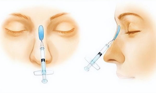 四、无痕去眼袋的成效维持时间