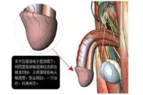 三、瘦脸针后不同阶段的护理要点