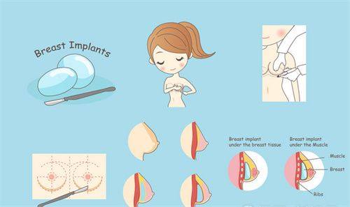 二、分眼型定制:让双眼皮自然又灵动还放大双眼