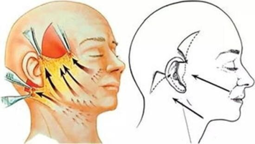 二、日常护理加速消肿,让修复快人一步