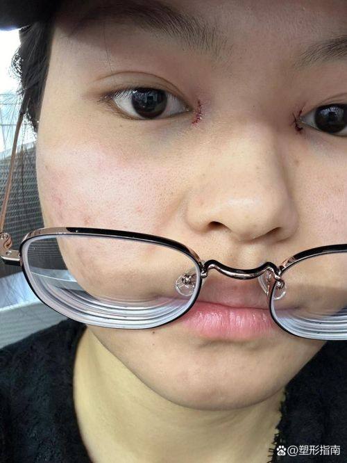 兰州莱尚医疗美容门诊部口碑评价：