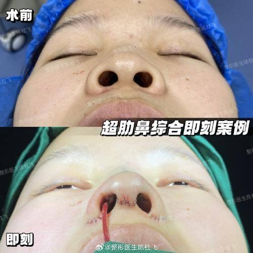 渭南凡尔赛明雅医疗美容诊所口碑评价：