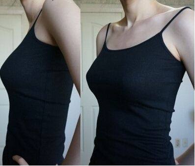 兰州莱尚医疗美容门诊部擅长项目：