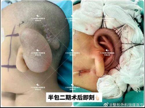 西安唯娜美颜医疗美容医生名单及擅长领域：