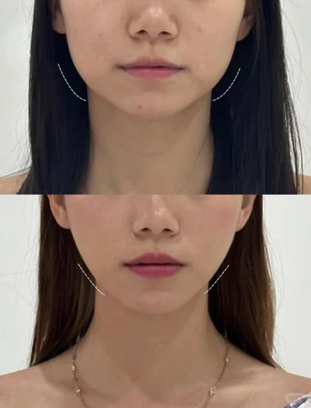 兰州莱尚医疗美容门诊部医生名单及擅长领域：