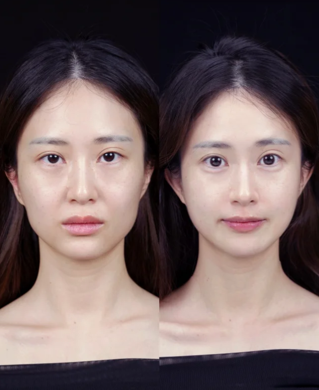 呼和浩特五维医疗美容诊所怎么样？