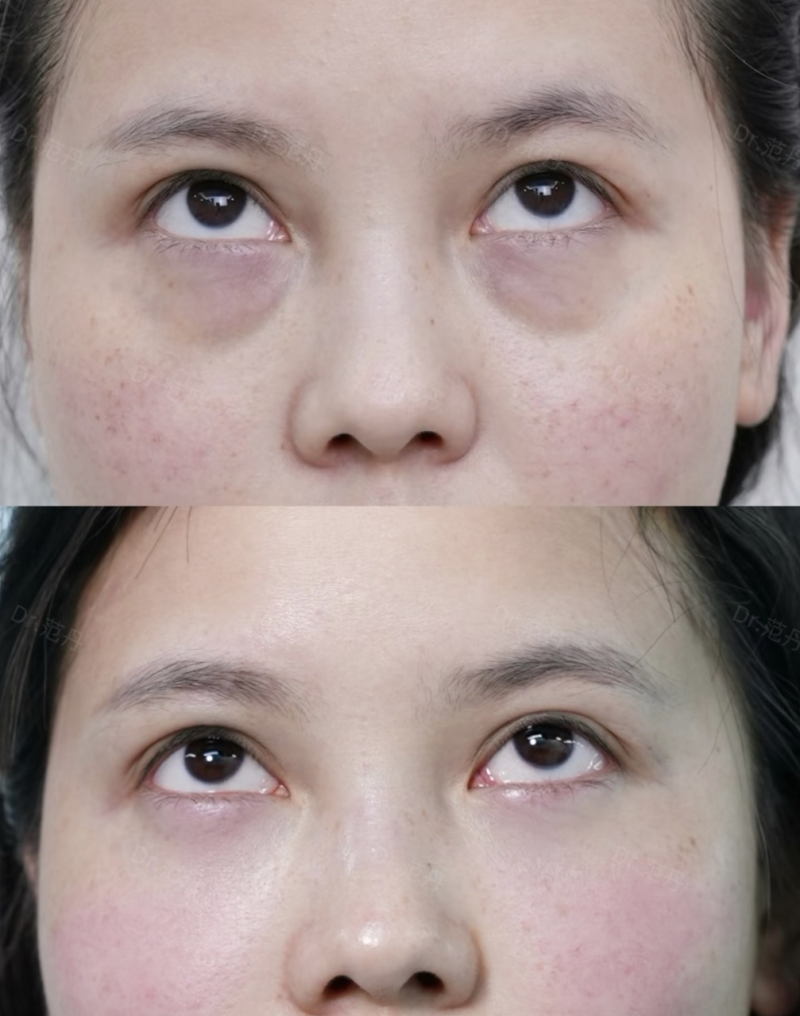 兰州莱尚医疗美容门诊部怎么样？