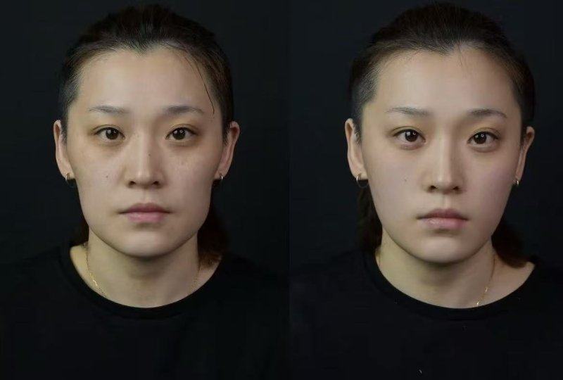 呼和浩特五维医疗美容诊所擅长项目：