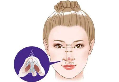 北京巴媞娜整形医院口碑评价：