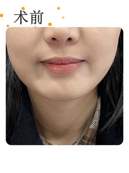 北京京美会医疗美容诊所擅长项目: