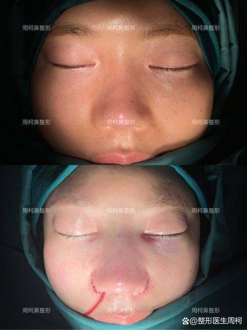 沧州中妤医疗美容诊所地址电话及营业时间：