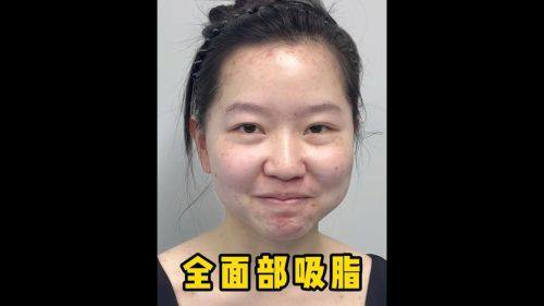 枣庄安瑞吉拉整形医院地址电话及营业时间