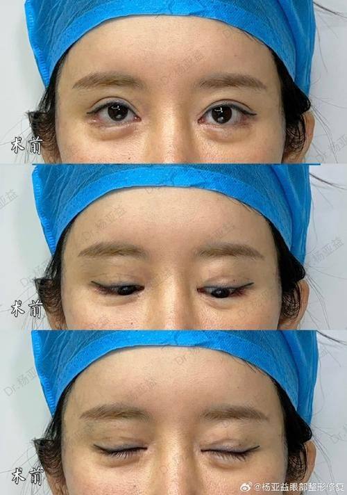 沧州中妤医疗美容诊所预约挂号方式：