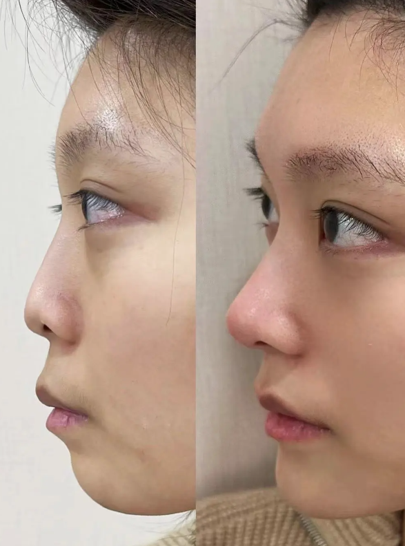 沧州中妤医疗美容诊所口碑评价：