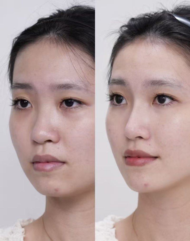 沧州中妤医疗美容诊所怎么样？