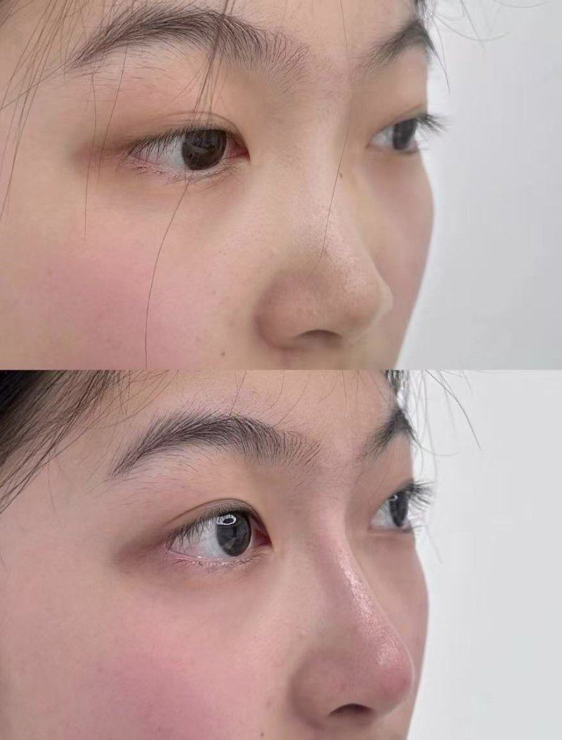 北京巴媞娜整形医院怎么样？