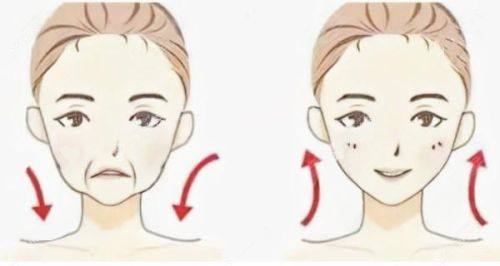 六、如何降低取肋软骨的潜在风险