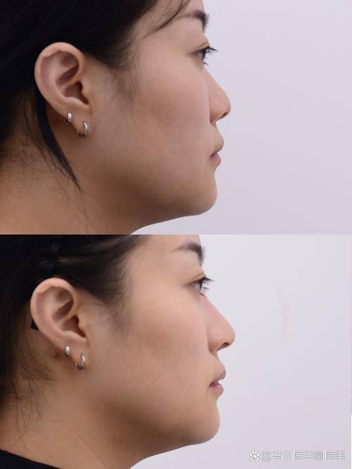 上海美仑医疗美容门诊部医生名单及擅长领域：