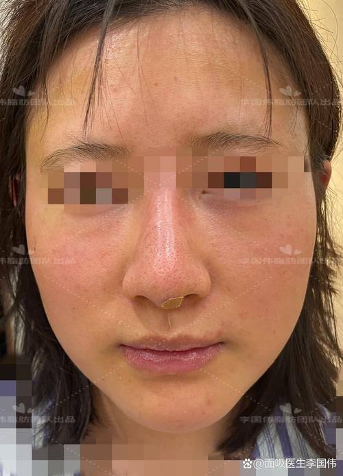 深圳锦瑄医疗美容诊所怎么样？