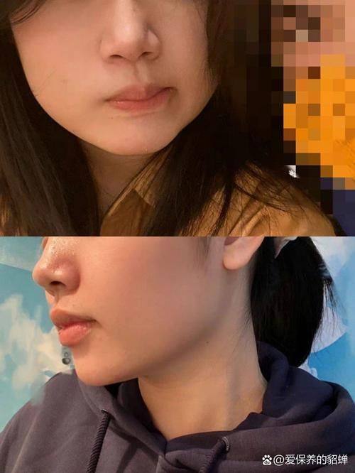 上海美仑医疗美容门诊部价格表