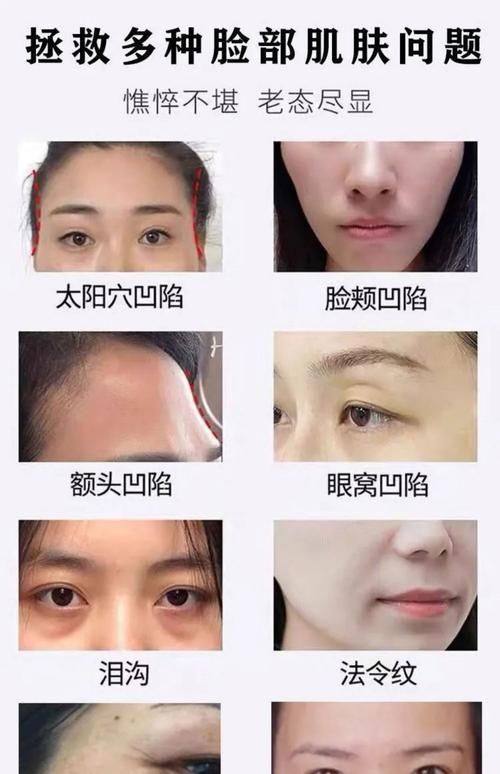 潜江蓝鸟医疗美容诊所怎么样？