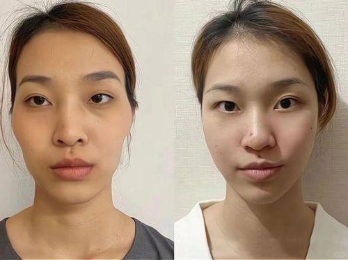 潜江蓝鸟医疗美容诊所地址电话及营业时间：