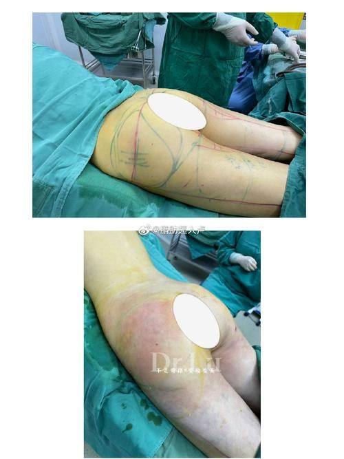 杭州浮想国医疗美容口碑评价