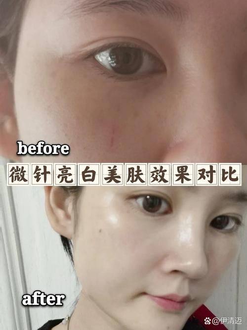 杭州秀华医疗美容诊所价格表: