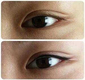 杭州秀华医疗美容诊所预约挂号方式: