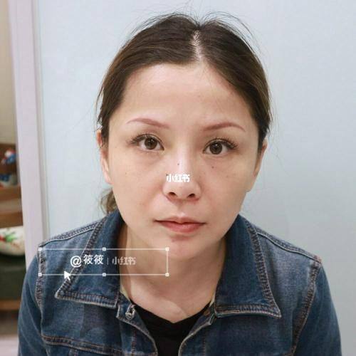 潜江蓝鸟医疗美容诊所预约挂号方式：