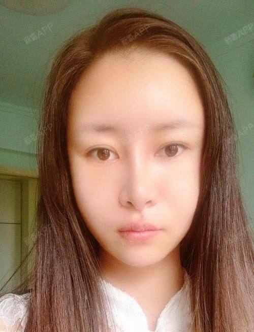 杭州浮想国医疗美容怎么样