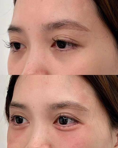 杭州浮想国医疗美容预约挂号方式