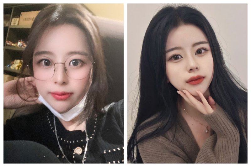 四、关于瘦脸针多次无效的常见误区解答