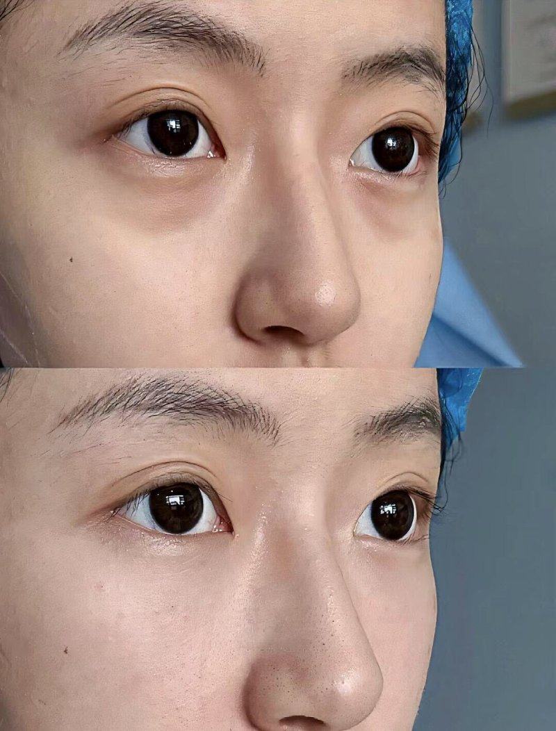 天津妍颜美医疗美容诊所价格表: